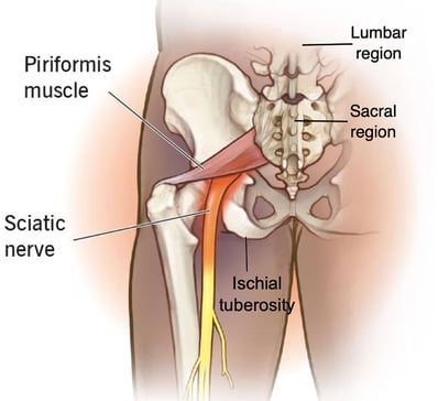 Sciatic Nerve
